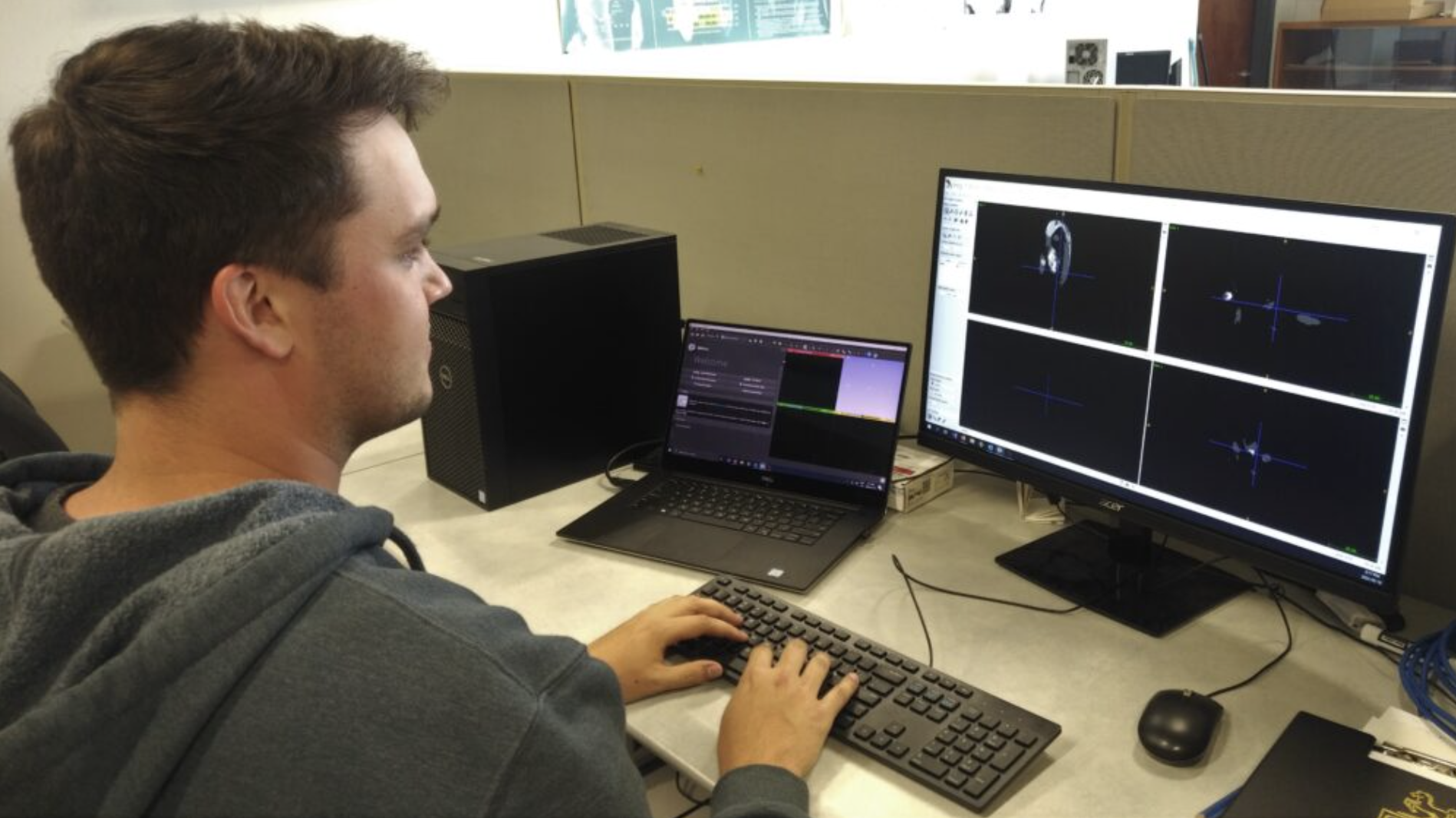 AI Ultrasound Analysis Research