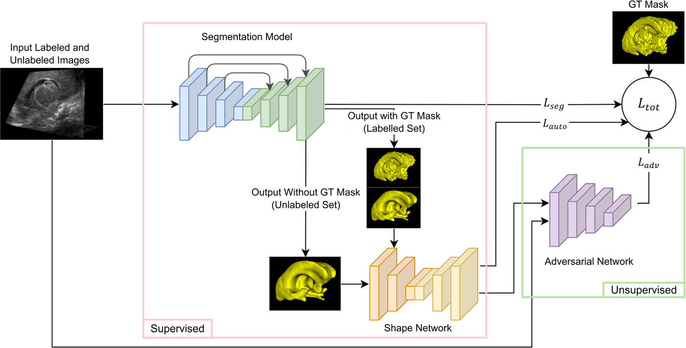 Semi-supervised learning framework with shape encoding for neonatal ventricular segmentation from 3D ultrasound