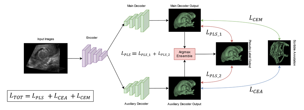 Scribble-based weakly supervised method for segmentation of neonatal cerebral ventricles from 3D ultrasound images