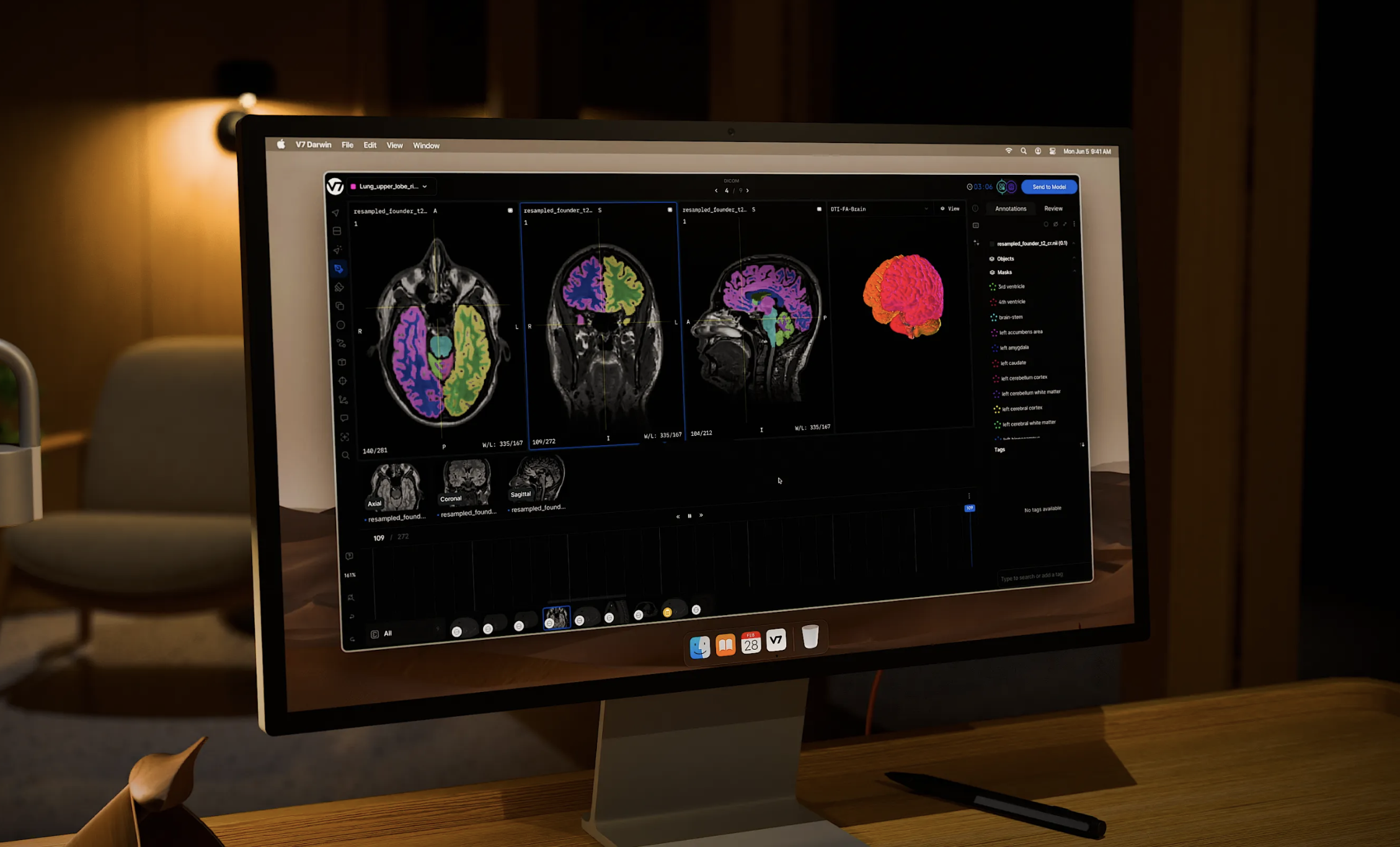 Brain segmentation with colored overlays