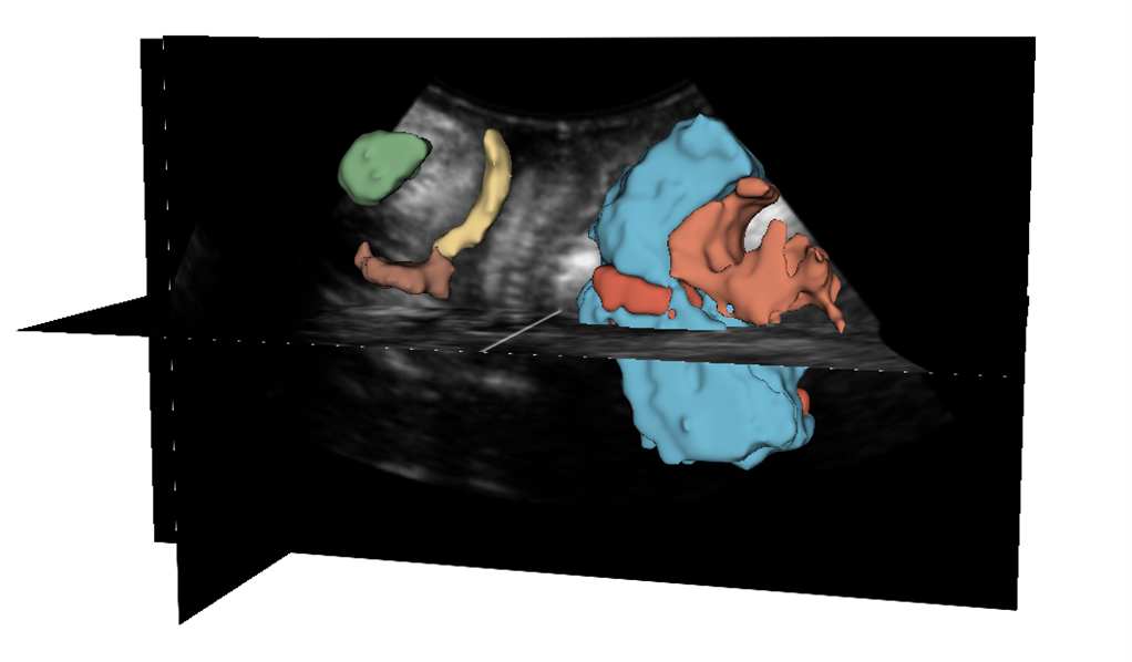 Pelvic floor analysis visualization