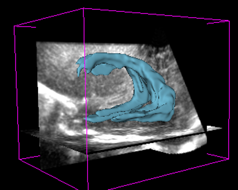 Medical imaging example visualization